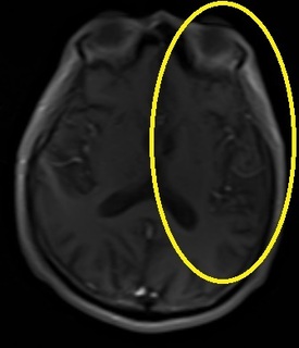 N1-2a.jpg