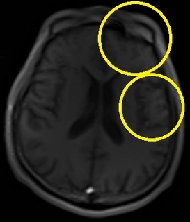 N1-3a.jpg