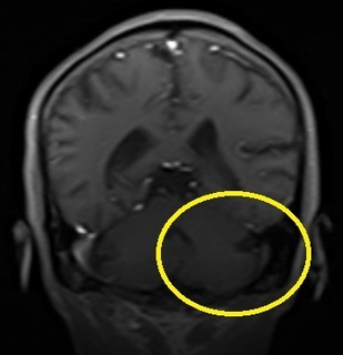 N1-6a.jpg